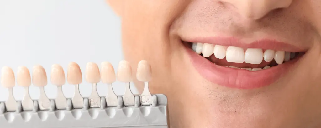 Christchurch Teeth Whitening